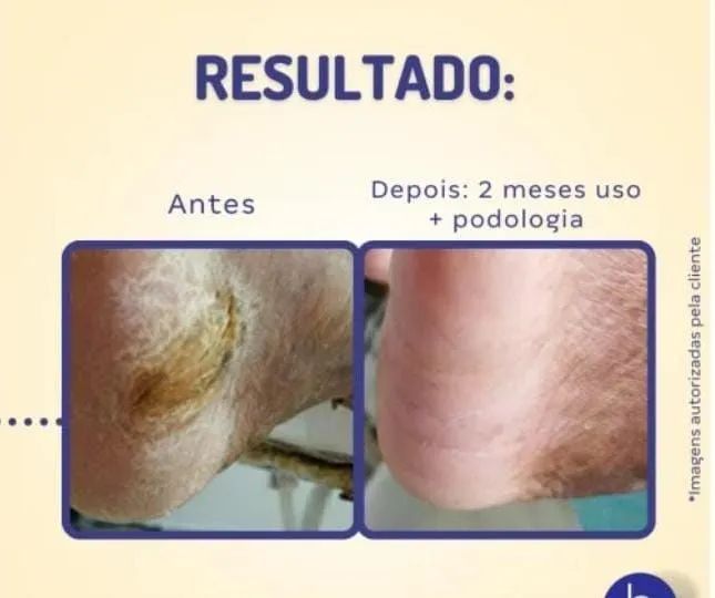 Homeopast Ultra Hidratação - Cuidado Completo para a Pele - Foto 5