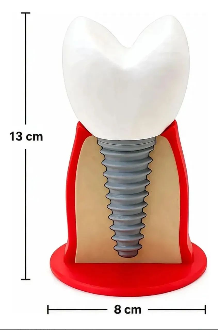 Macro modelo didático de implante dentário  - Foto 2