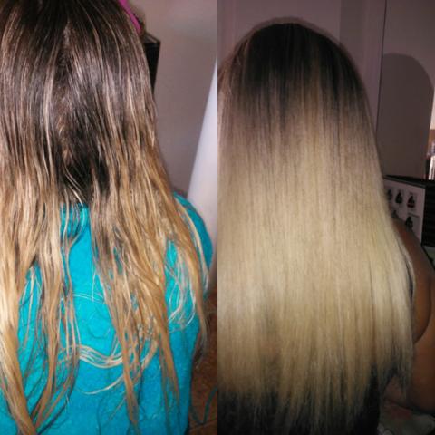 Promoção botox por apenas 50,00 e ganhe manicure - Foto 2