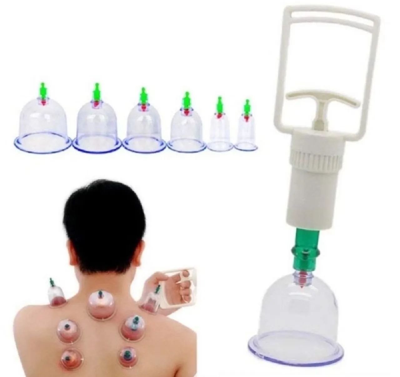 Kit com 6 ventosas + bomba de sucção  - Foto 2