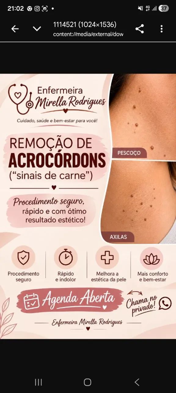 Retirada de Sinais  - Foto 2