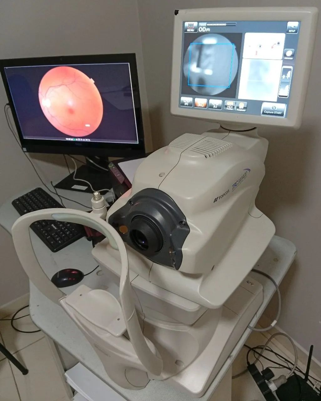 Retinógrafo Topcon TRC-NW 400 - Foto 4
