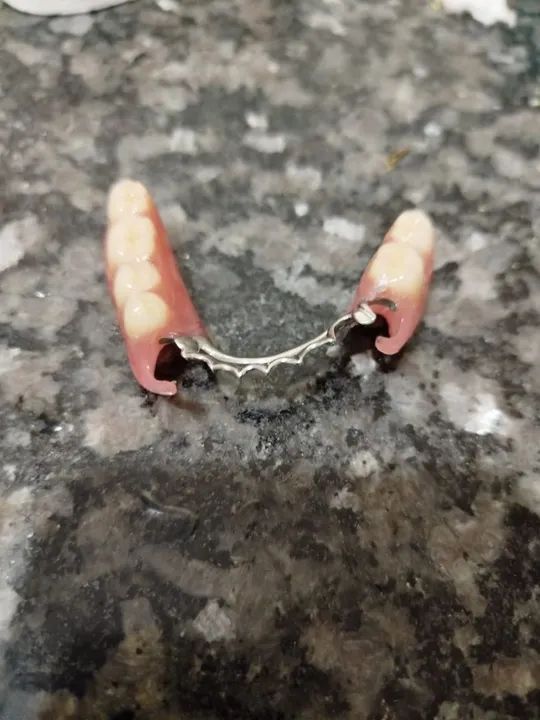 Prótese Dentária  - Foto 3