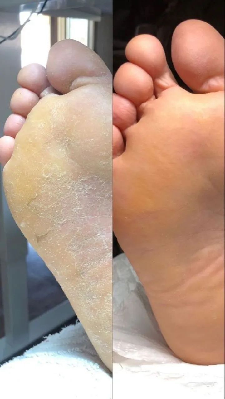 Plástica dos pés /Eldorado contagem 64167812291459122