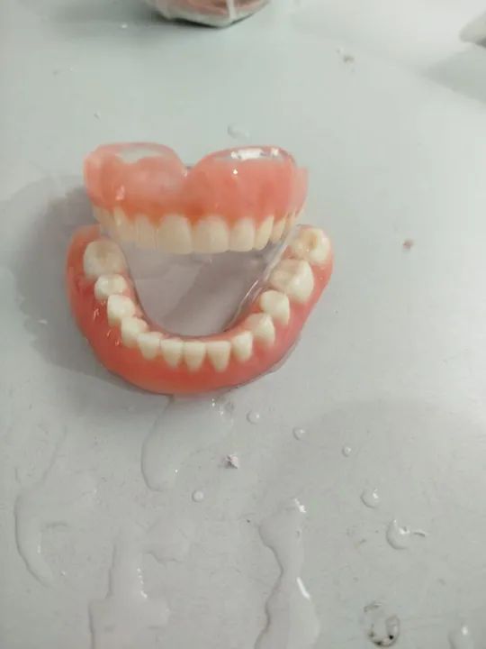 Prótese Dentária  - Foto 2