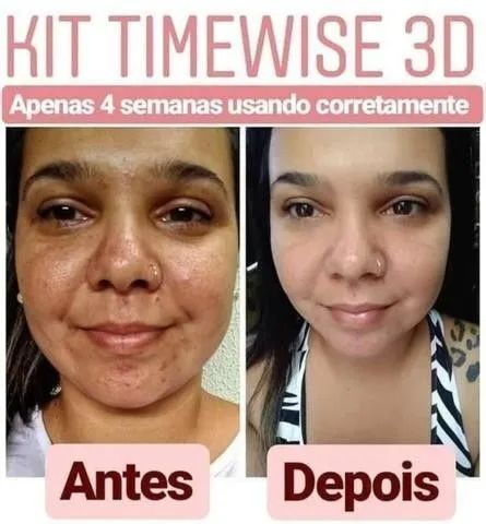 Base TimeWise 3D: A queridinha das brasileiras! ? - Foto 5