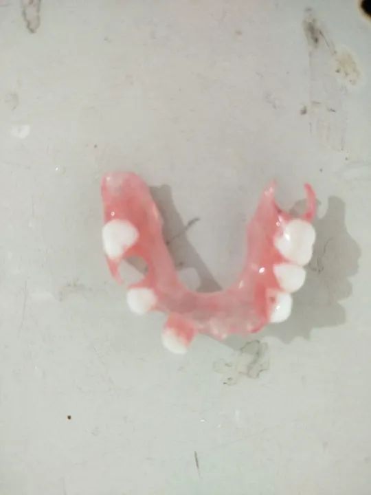 Prótese Dentária  - Foto 4