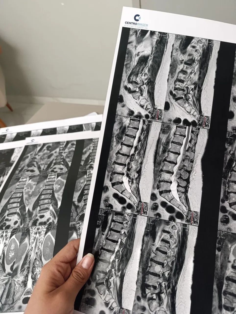 Fisioterapia domiciliar  - Foto 4