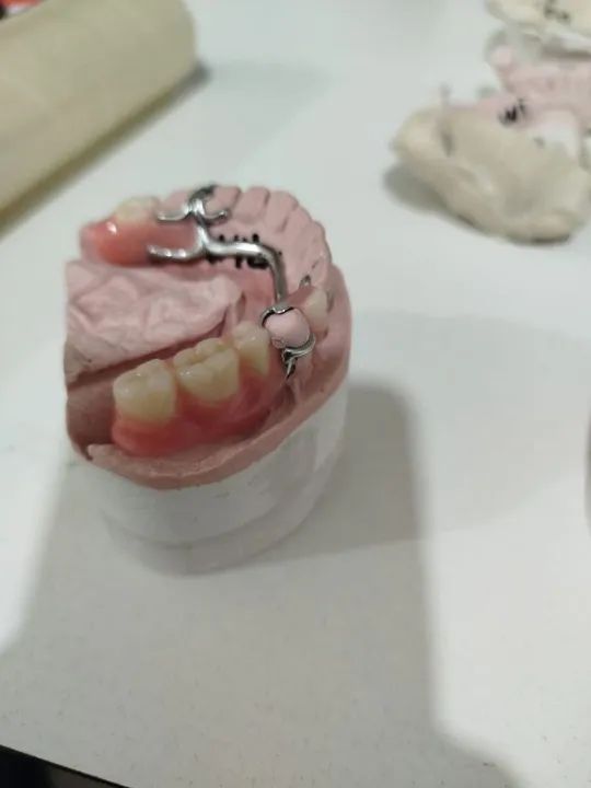 Prótese Dentária  - Foto 6