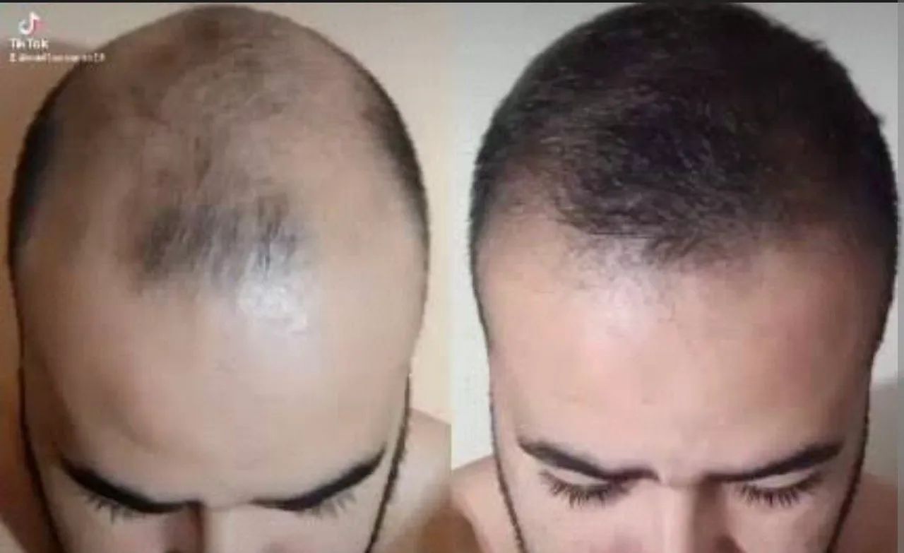 Barba, cabelo e sombrancelhas  - Foto 3