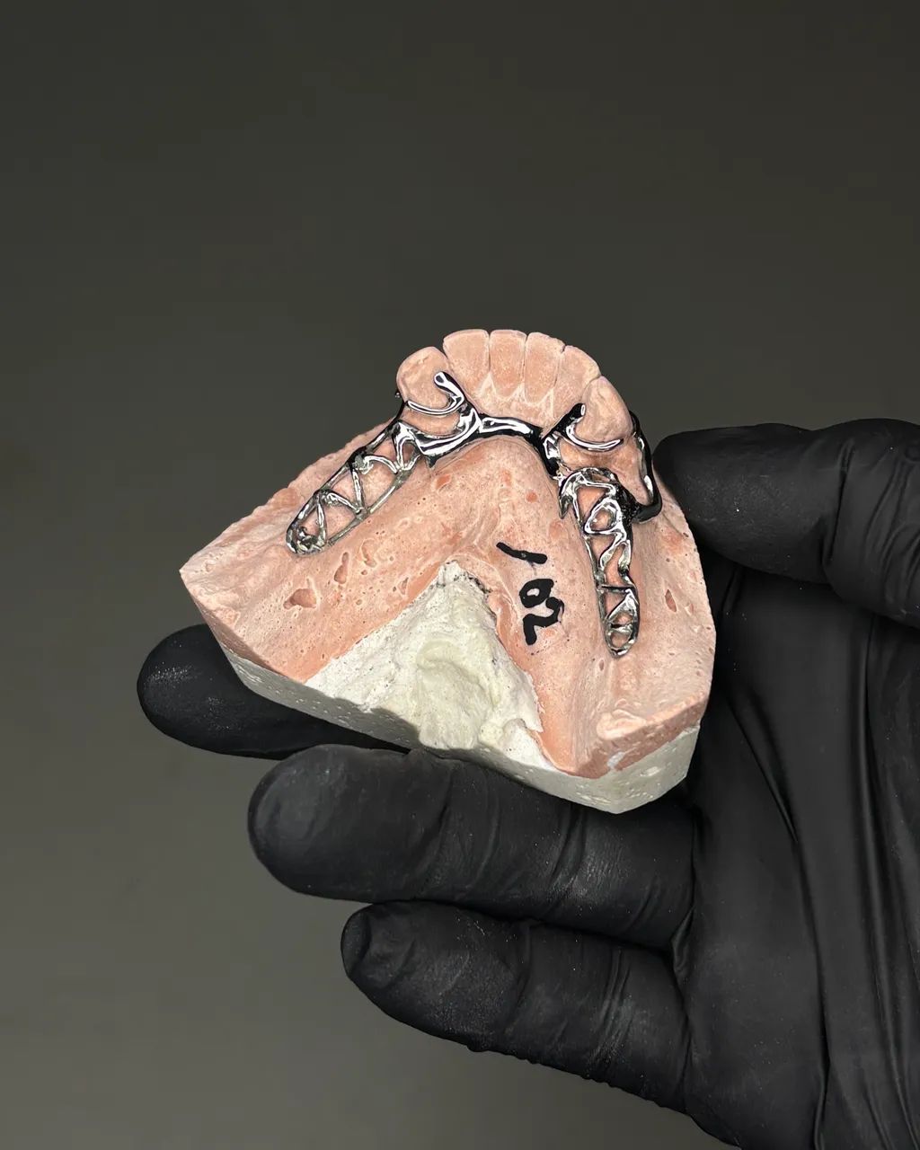 PPR. Prótese Parcial Removível Metálica - Foto 3