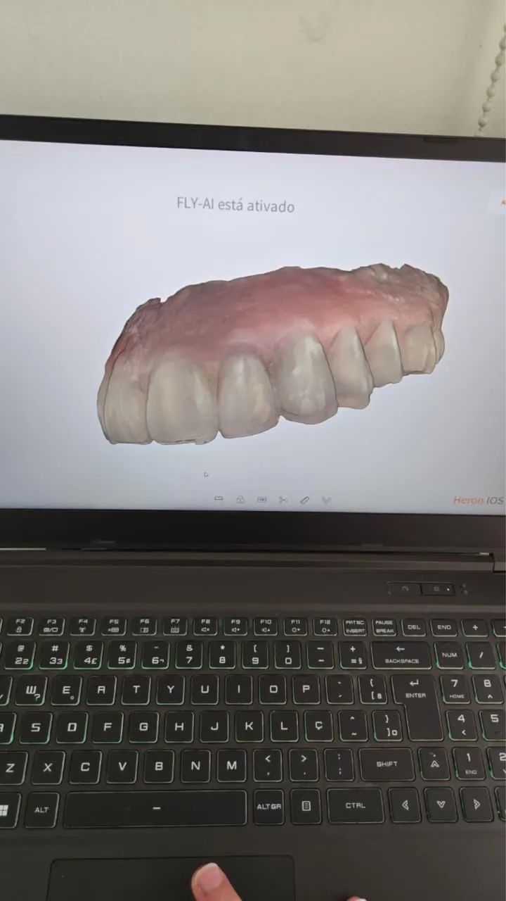  Scanner Intraoral 3D Heron IOS - Foto 4
