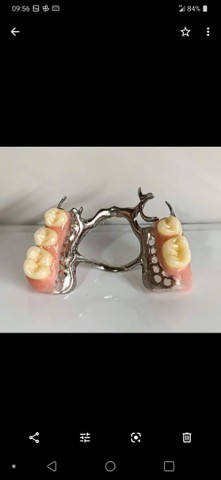 Próteses Dentária - Foto 5