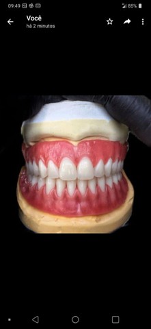 Próteses Dentária