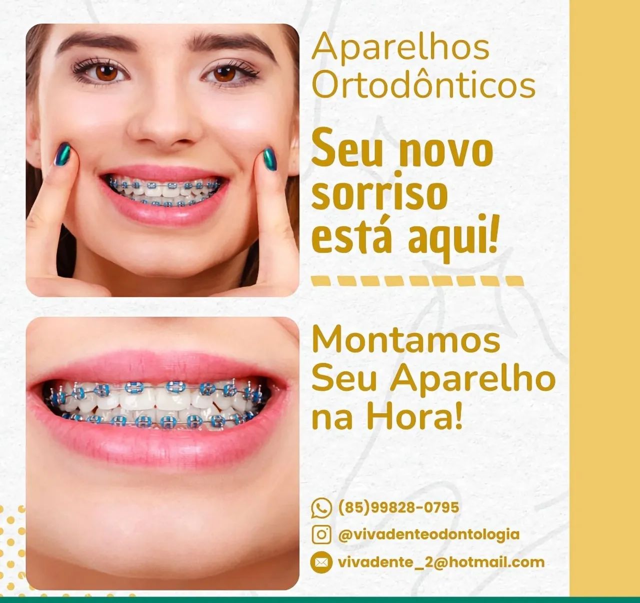 Aparelho ortodôntico manutenção  - Foto 3