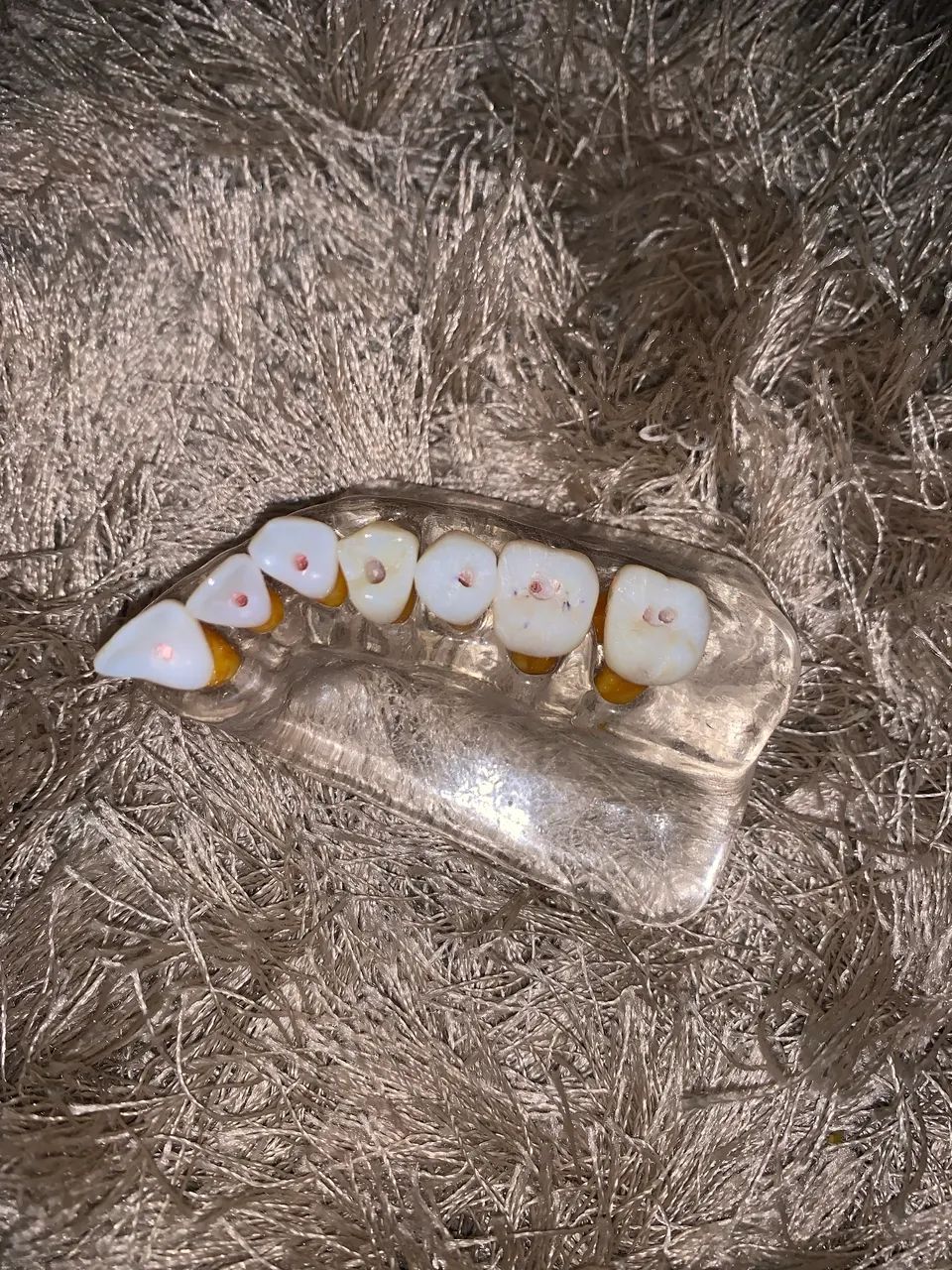 Gengival artificial  + dentes 