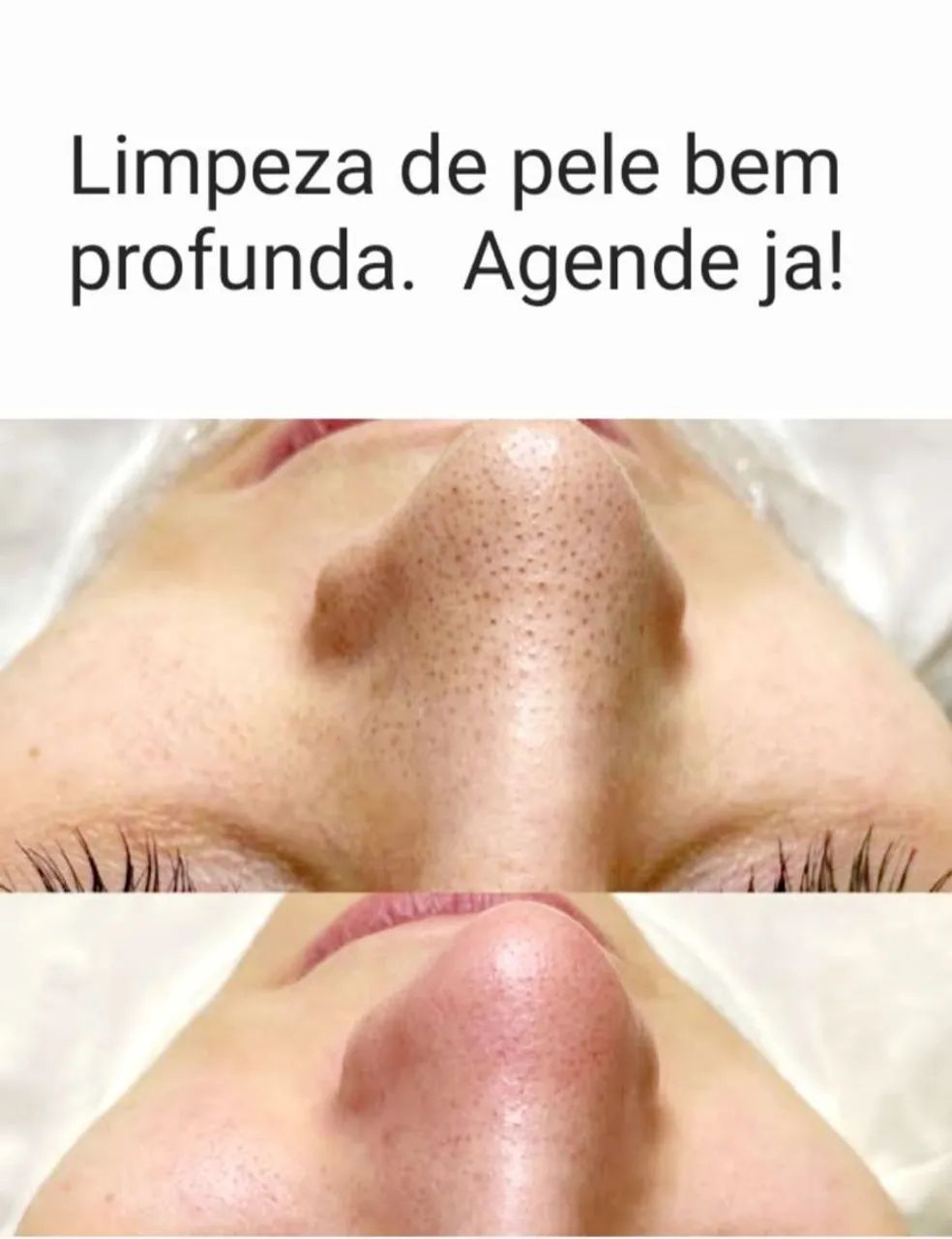 Limpeza de pele bem profunda 