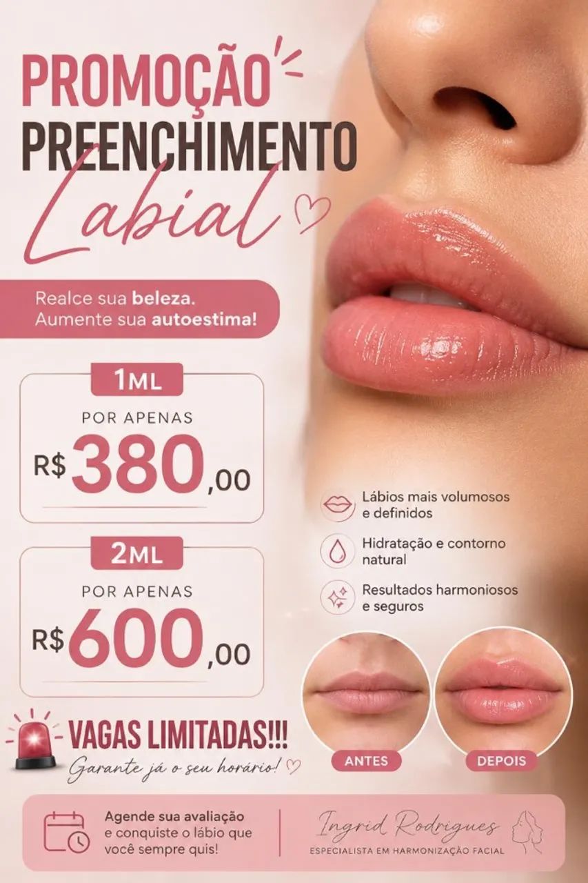 Promoção preenchimento labial