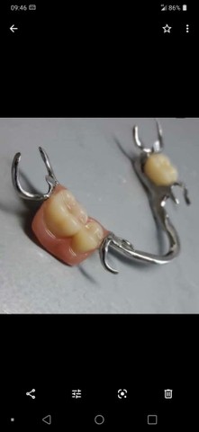 Próteses Dentária - Foto 2