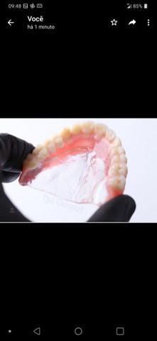 Próteses Dentária - Foto 4