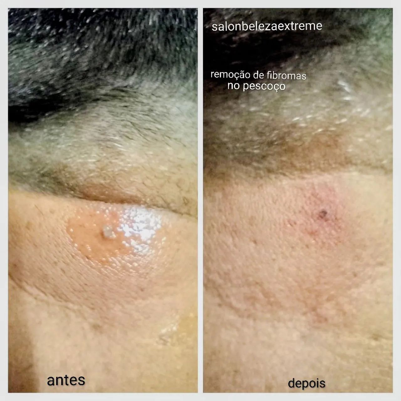 Estética avançada e completa.  - Foto 2
