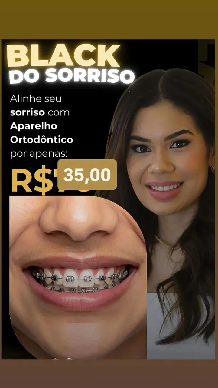 Aparelho ortodôntico manutenção  - Foto 4