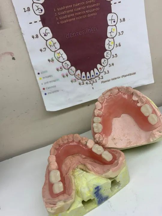 Prótese dentárias a partir de 200 reais  - Foto 3