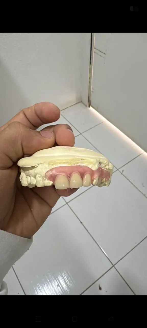 Dentadura + Flex + PLATINA  - Foto 2