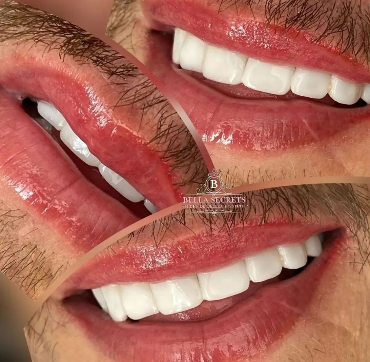 Micropigmentação Labial expert  - Foto 2