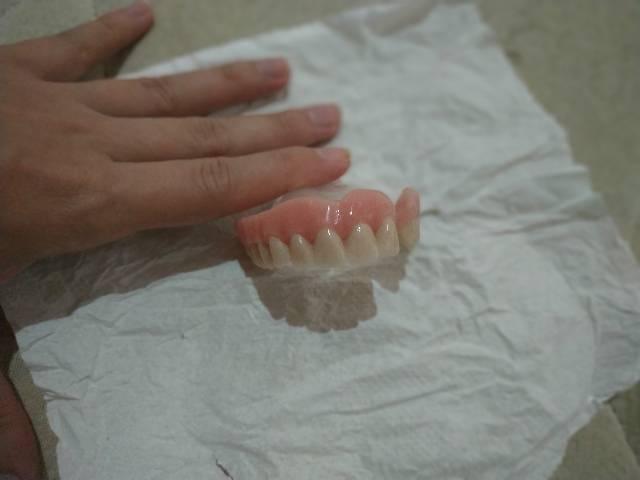 Prótese dentária para consultório - Foto 4
