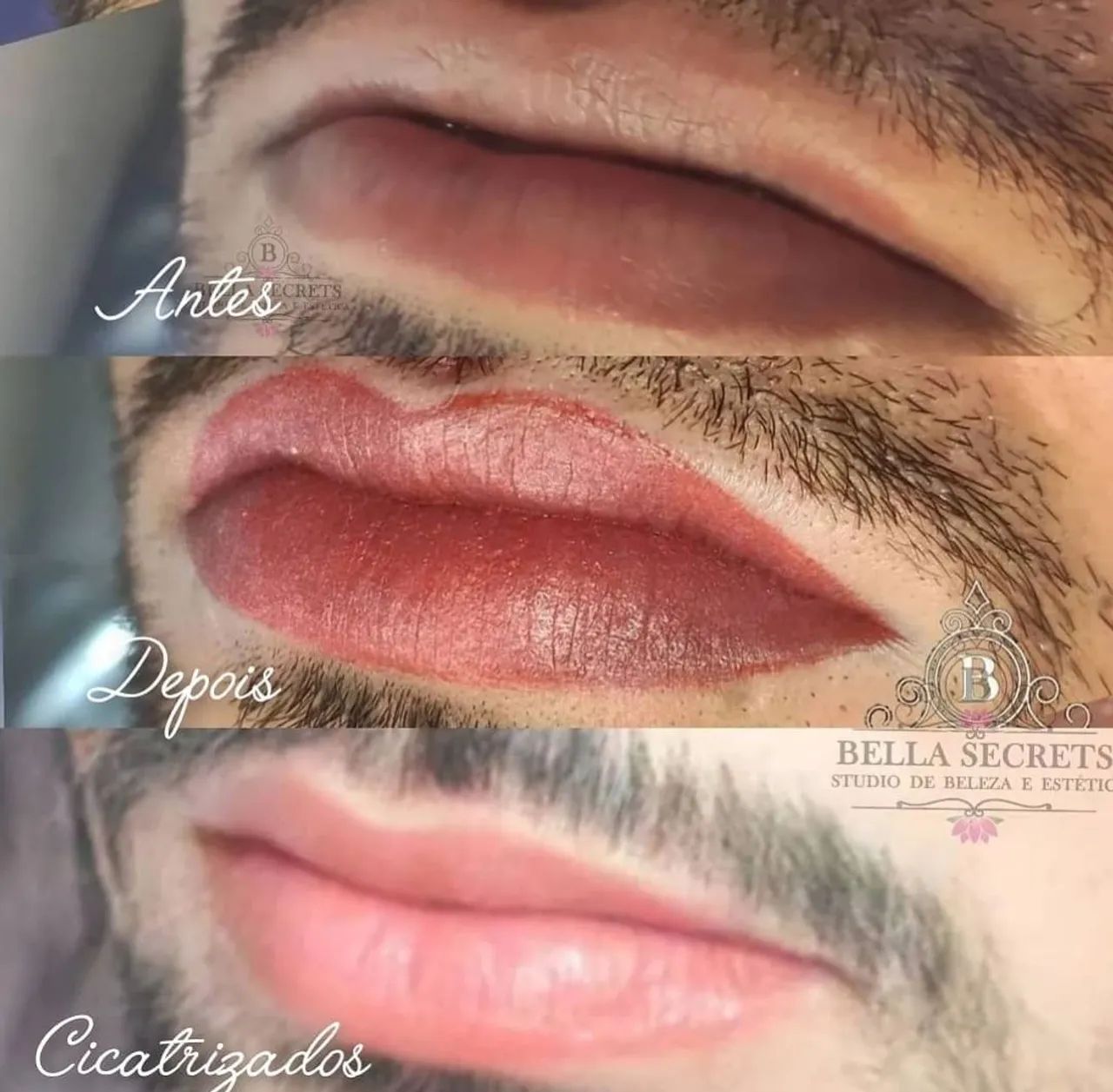 Micropigmentação Labial expert  - Foto 3