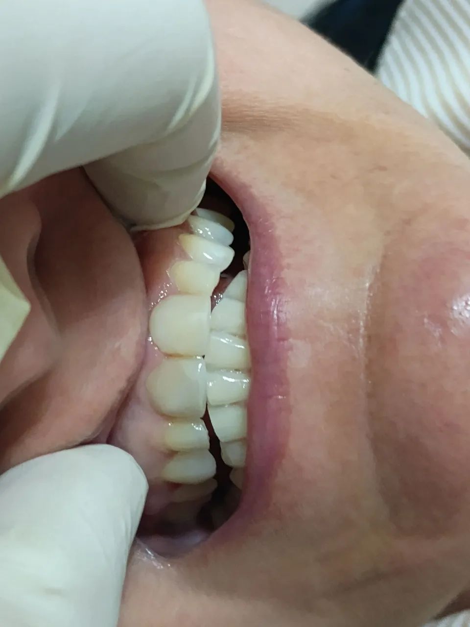 Dentista a domicílio  - Foto 4