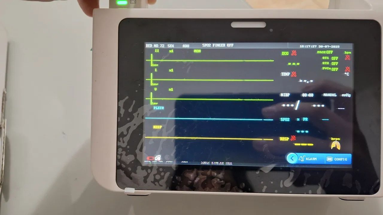 Monitor Multiparamétrico para Pacientes - Novo! - Foto 4