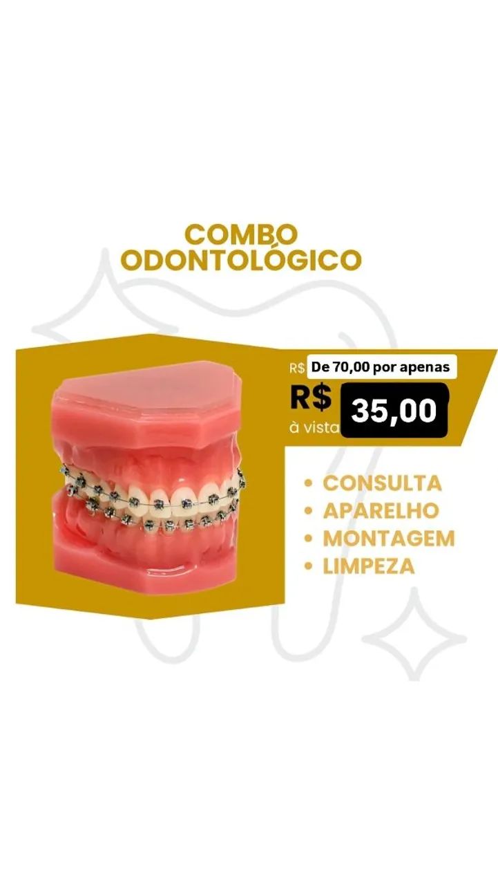 Aparelho ortodôntico manutenção  - Foto 5