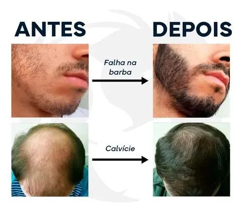 Barba, cabelo e sombrancelhas  - Foto 5