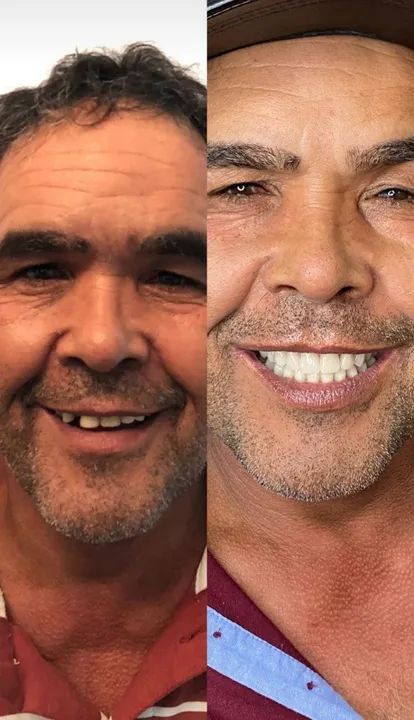 Dentadura!!! - Foto 3