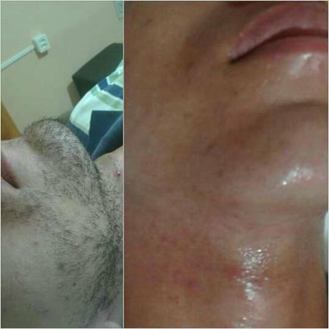 Pro homem vaidoso local próprio pra vc