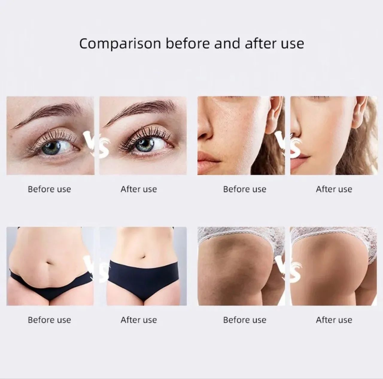 Lipolaser Lipo Cavitação 40k, Radiofrequência, Vácuo 6 Em 1127/220v - Foto 5