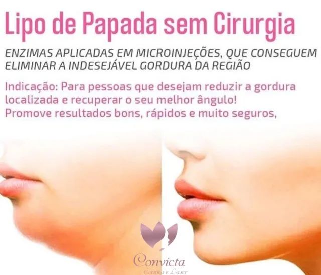 Convicta - Papada - Foto 2