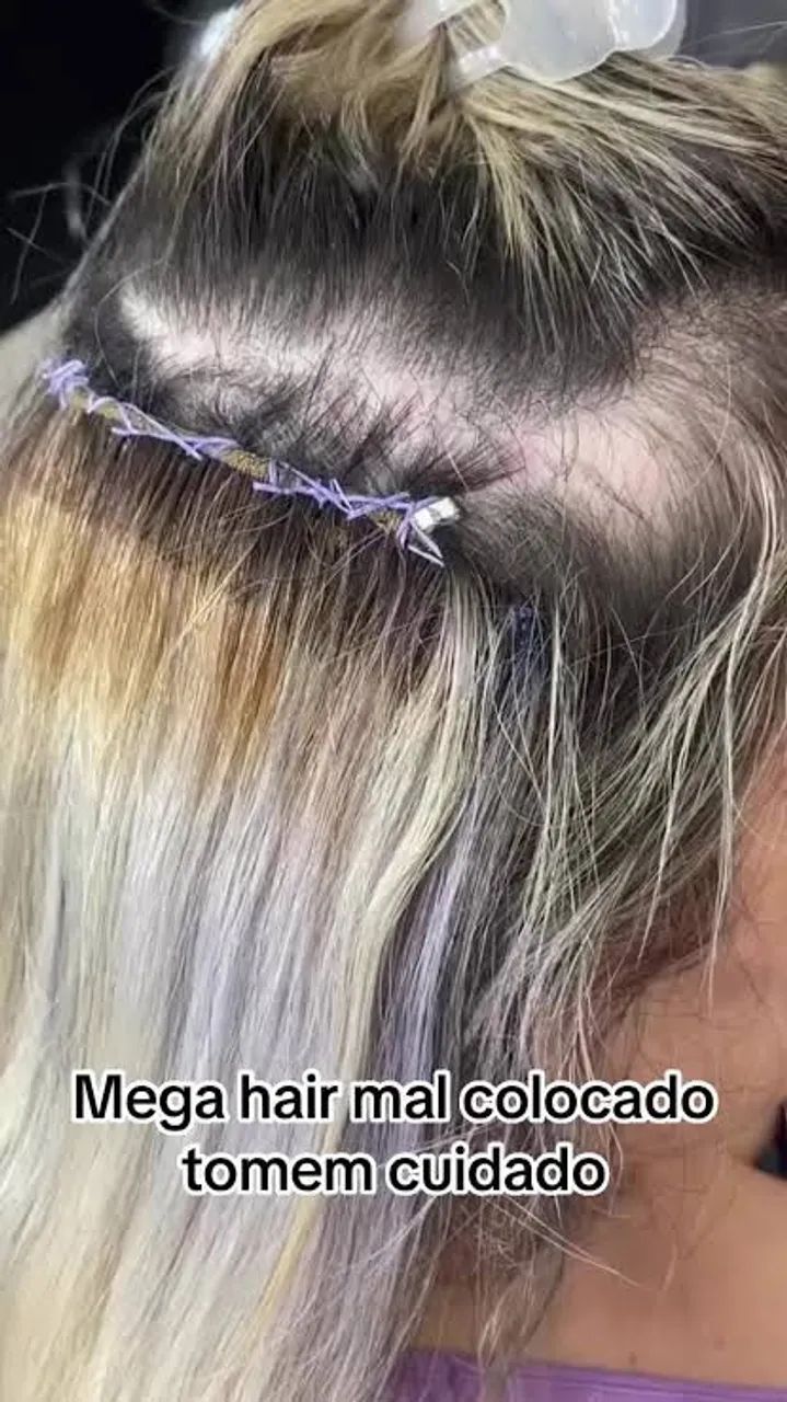   Correção de Mega Hair - Resultado Natural e Sem Dor! - Foto 2