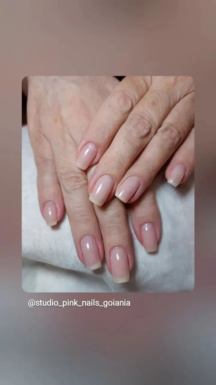 Alogamentos de unhas  - Foto 5