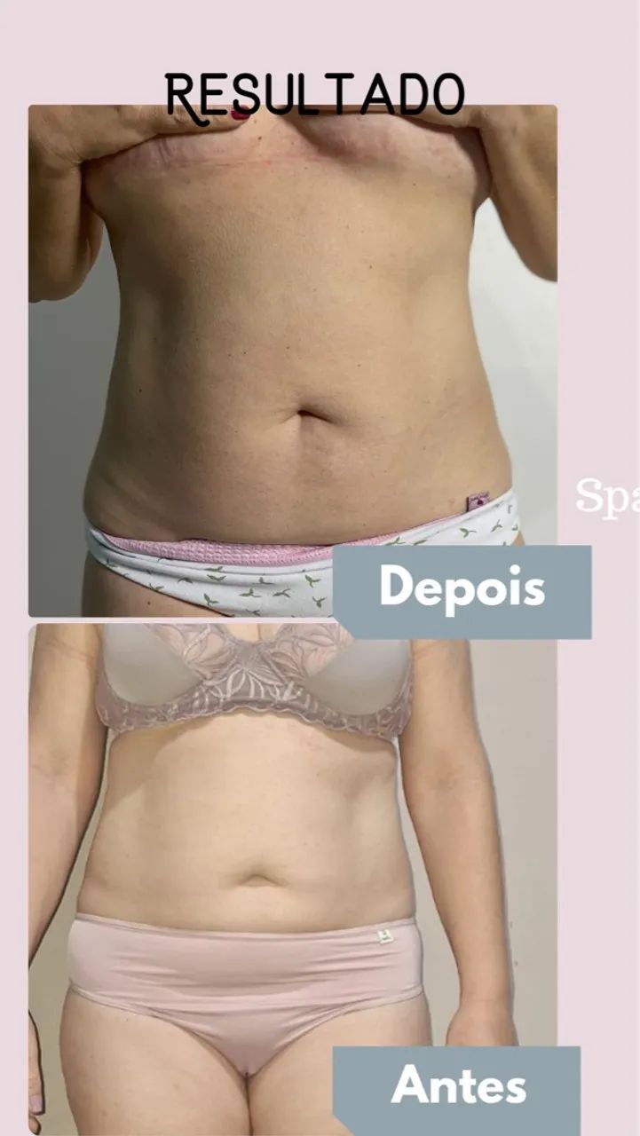 Criofrequencia Fismatek - Foto 6