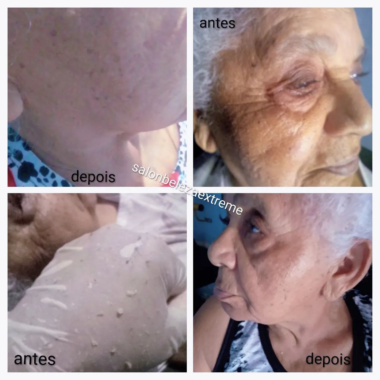 Estética avançada e completa.  - Foto 4