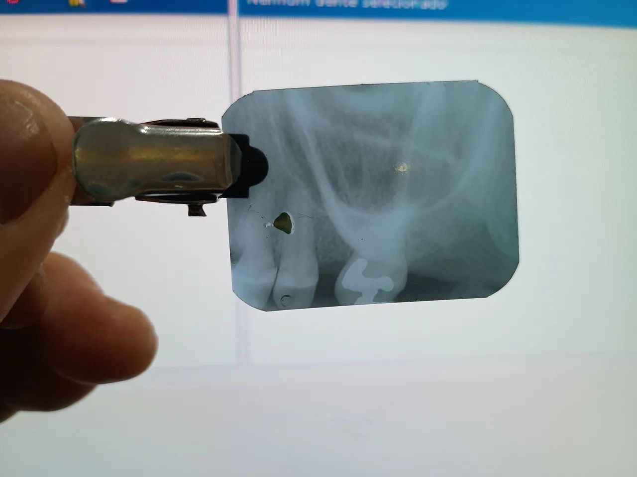 Dentista a domicílio  - Foto 5