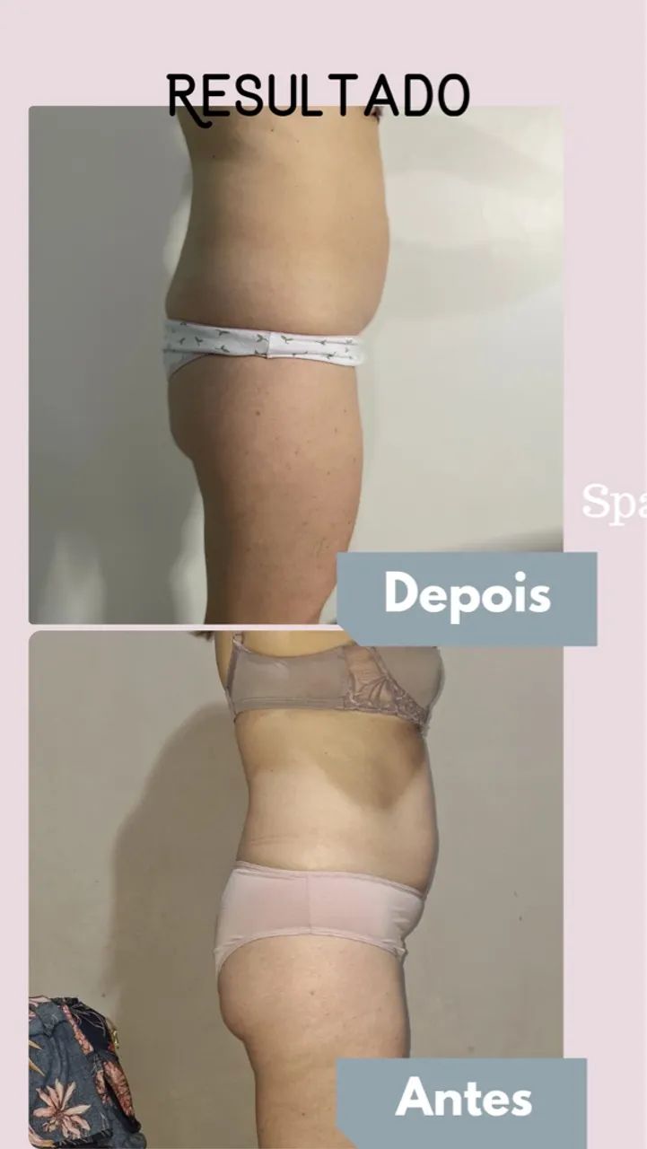 Criofrequencia Fismatek - Foto 5