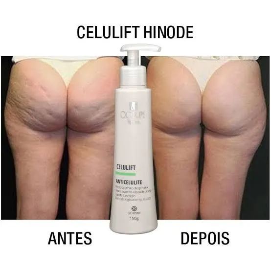 Corps Lígnea Celulift Creme Anti Celulite 150g - Hinode - Foto 4
