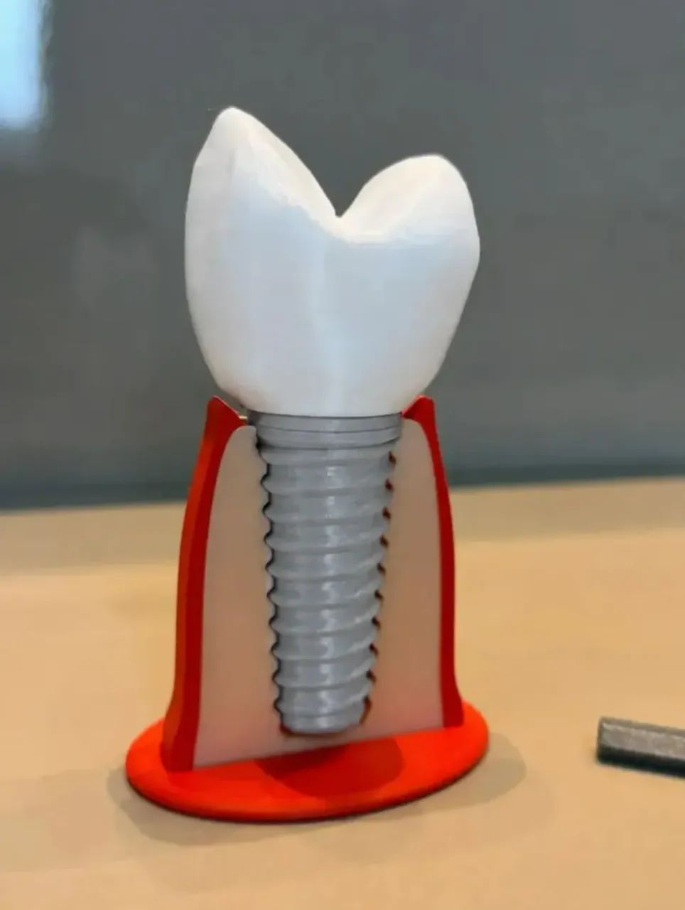 Macro modelo didático de implante dentário  - Foto 5