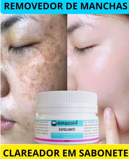Clareador de Manchas de pele - NOVO (Pagamentos somente na entrega)