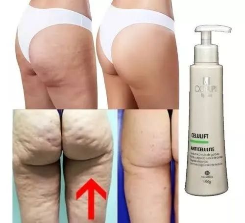 Corps Lígnea Celulift Creme Anti Celulite 150g - Hinode - Foto 3