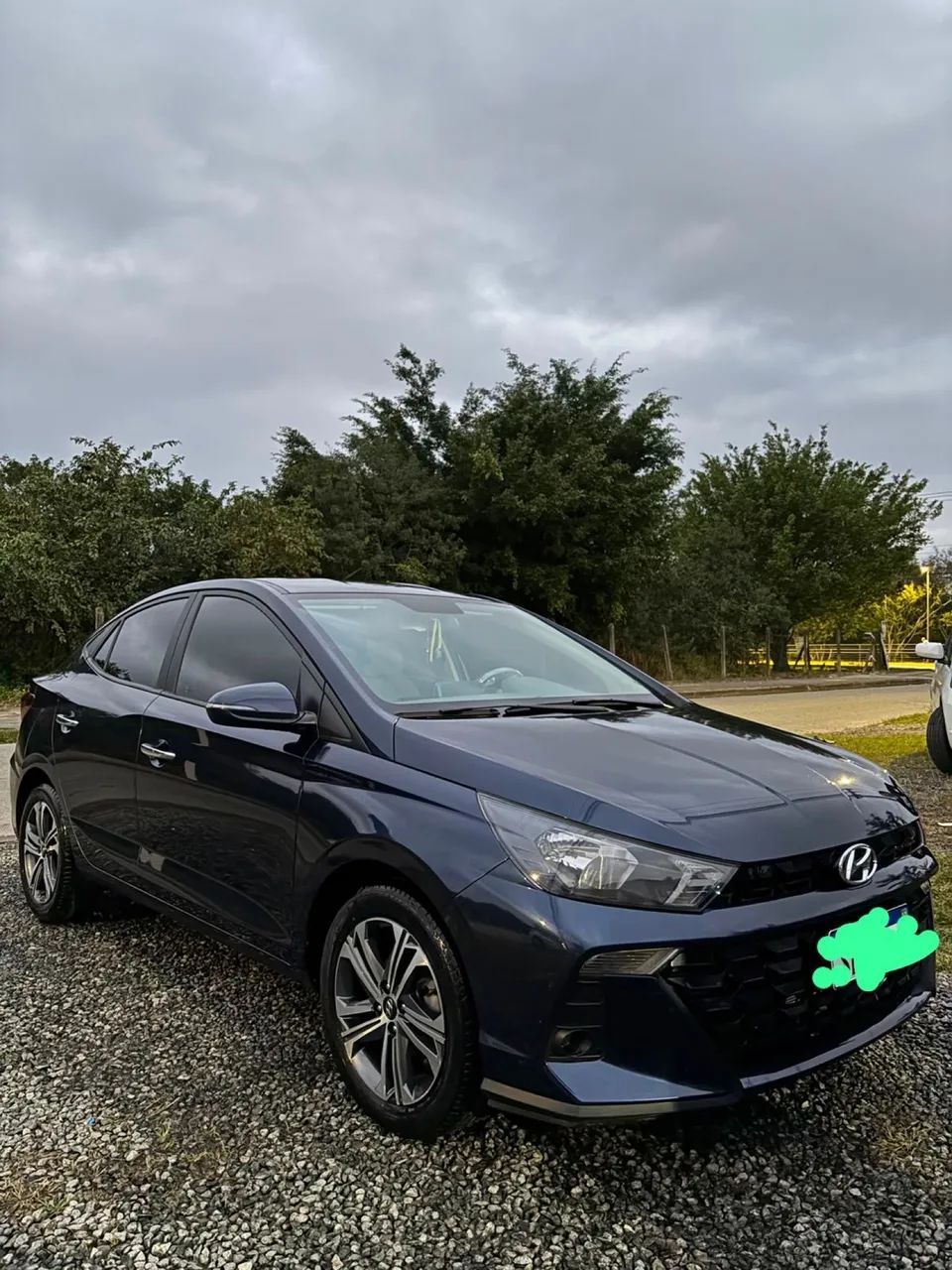 Hyundai Hb20S HB20S Platinum 1.0 TB Flex 12V Aut. 2023